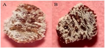 Biocontrol of Phenacoccus solenopsis Tinsley using entomopathogenic fungi and bacteria